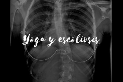 Yoga para escoliosis